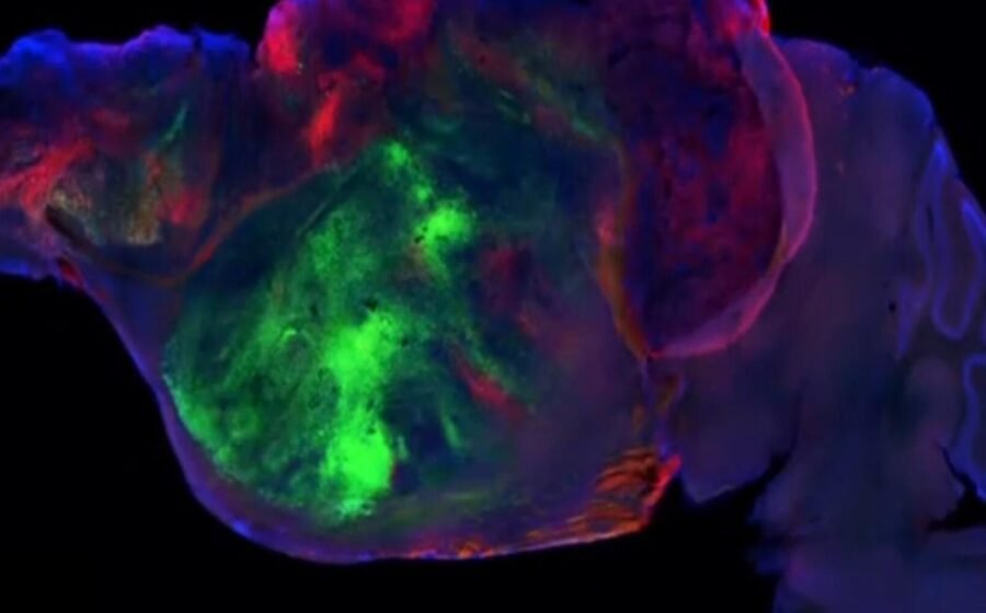 Neuroscientist explains how his team grew human brain tissue in mice and breaks down what they found
