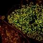 Chlamydia packs DNA with lipids, revealing possible target for blocking infection
