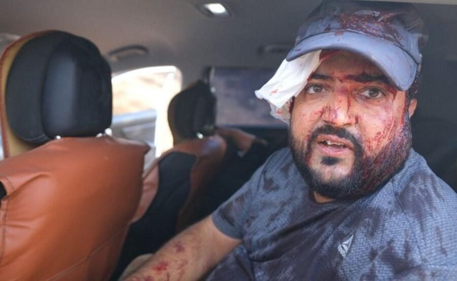 Palestinians and US journalist injured by Israeli settlers in West Bank harvest attack