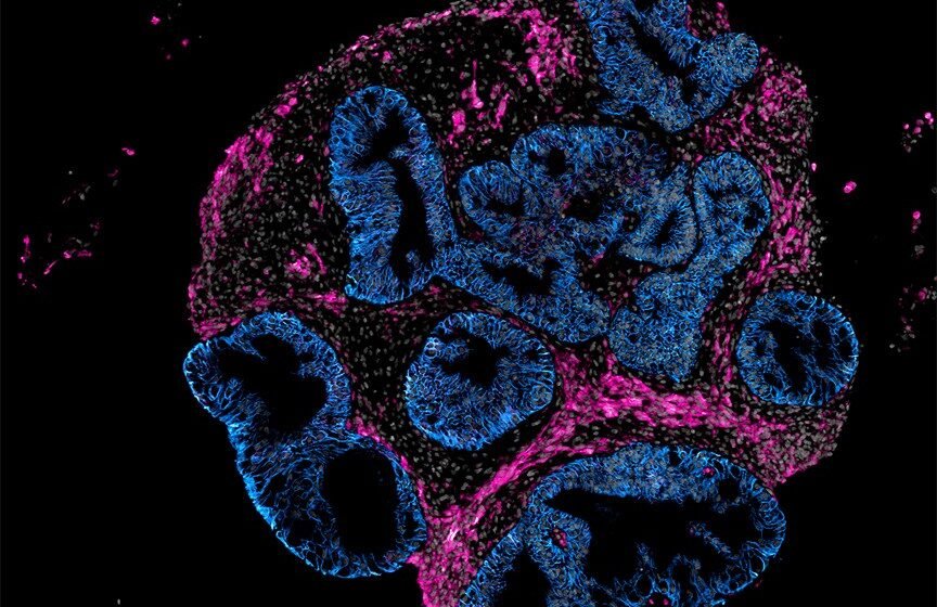 Intero Biosystems wants drugmakers to test on mini human intestines, not animals