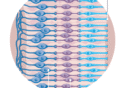 This implant can restore sight for patients with macular degeneration
