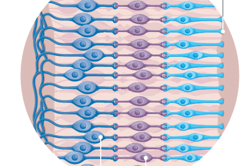 This implant can restore sight for patients with macular degeneration