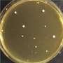 Candida auris copies its entire genome to survive antifungal treatment, research reveals